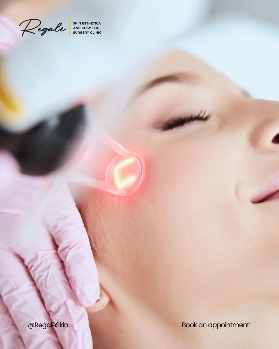 Laser skin treatment
